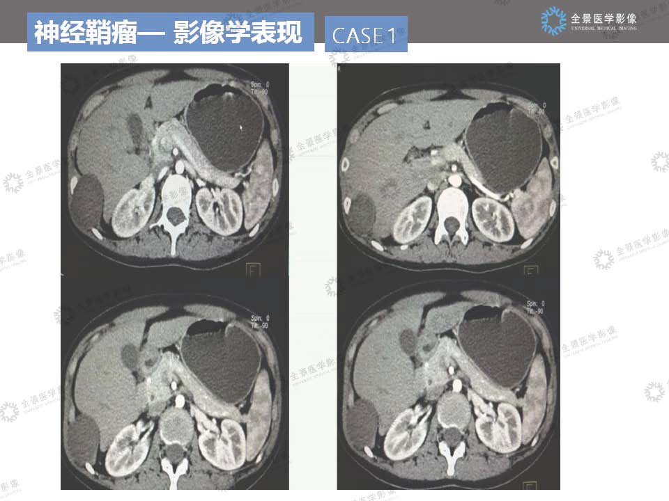 组合 3_页面_15