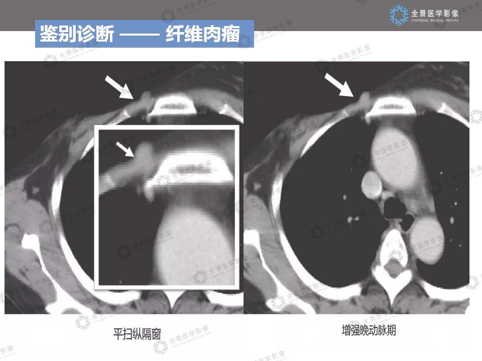 组合 3_页面_21