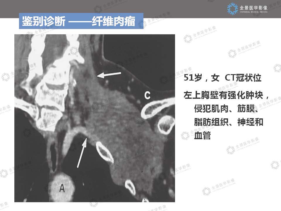 组合 3_页面_22