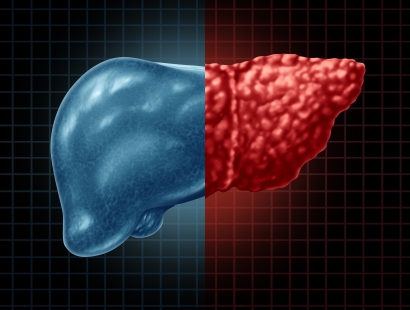 肝脏肿瘤检查方法