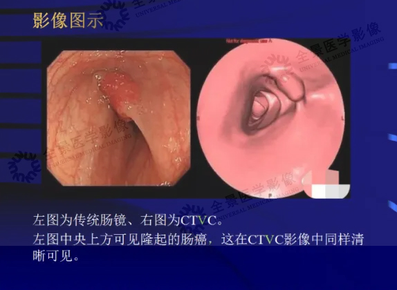 3+水印