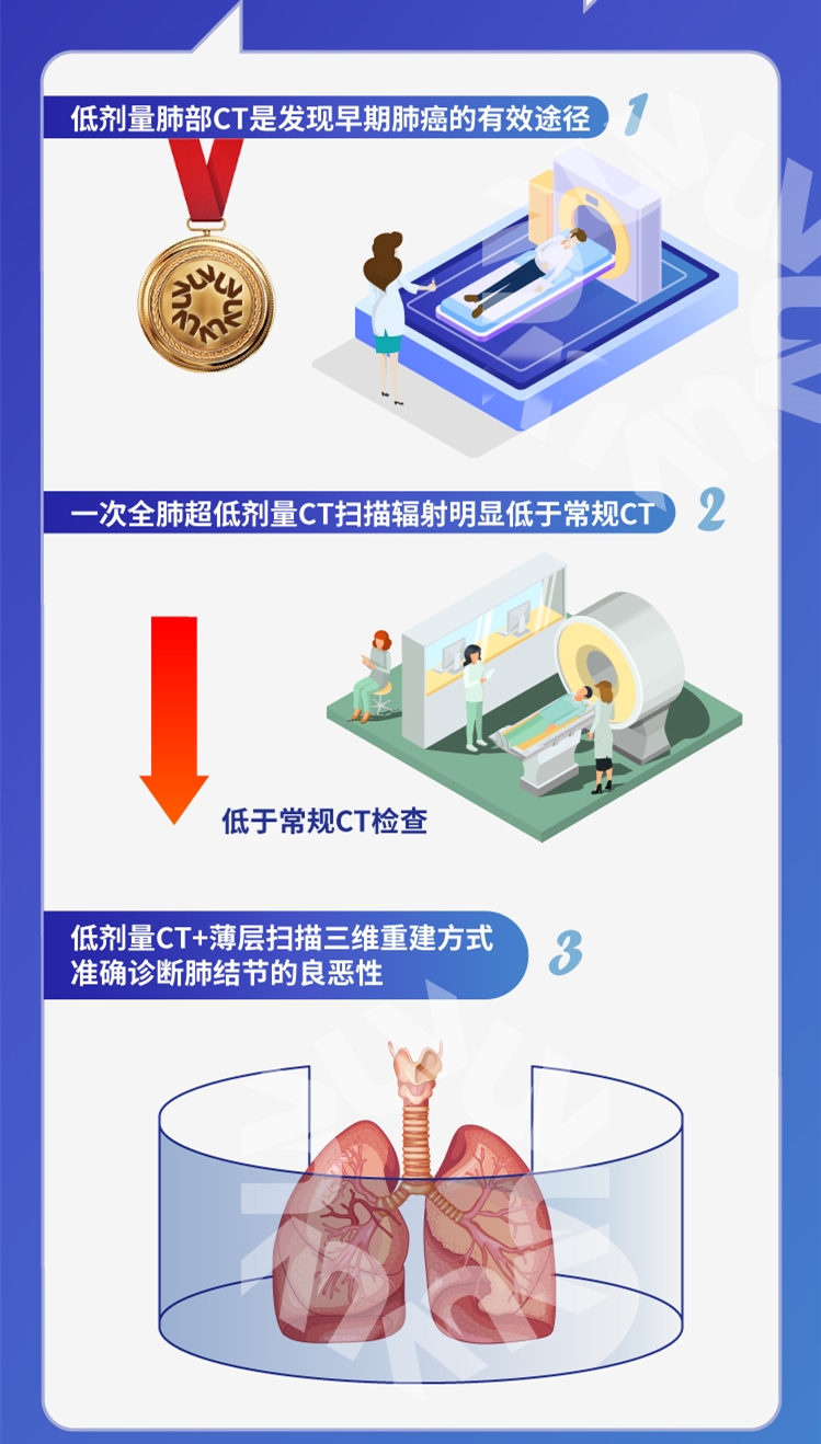 肺癌体检