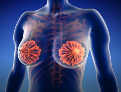 乳腺疾病检查方法